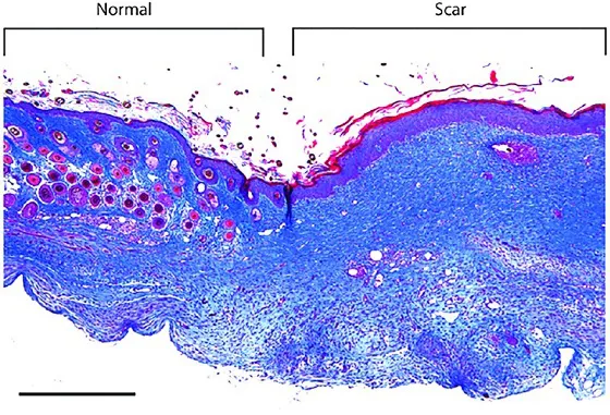 Image described by caption.