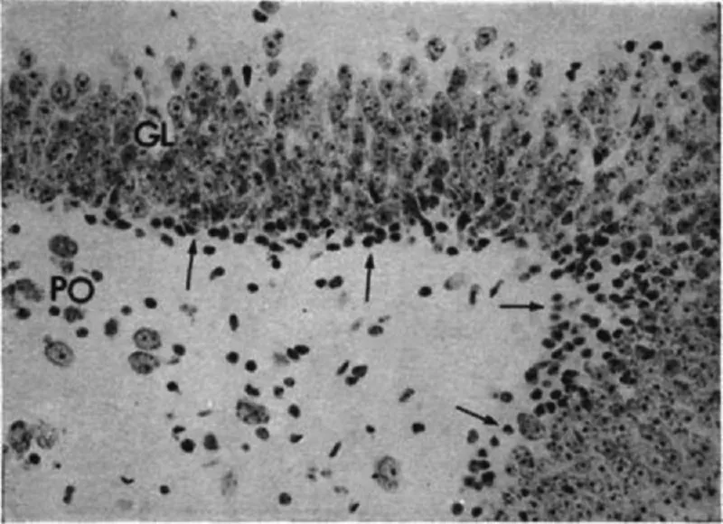 Image described by caption.