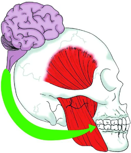 Diagram shows the connection between a skull, dental arch, neuromuscular structures, and the brain.