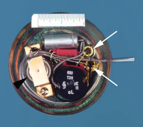 Photograph of Elmqvist-Senning pacemaker of 1958. The arrowhead points two nickel-cadmium cells. The two transistors are on the right (arrows).