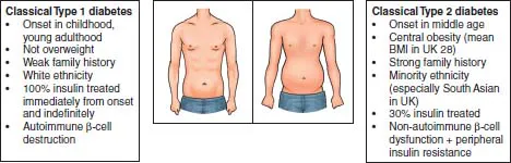 Charts: left- “Classical type 1 diabetes”, right- “Classical type 2 diabetes”. In between, two figures of upper half of man’s body showing abdominal region. Left- thin, flat; right- fat, bloated.