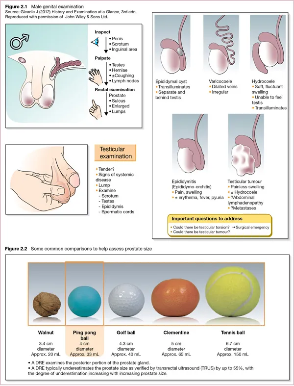 Image shows steps for male genital examination, testicular examination and shape of organ during abnormalities. It also shows objects like walnut, golf ball et cetera to compare and assess prostrate size.